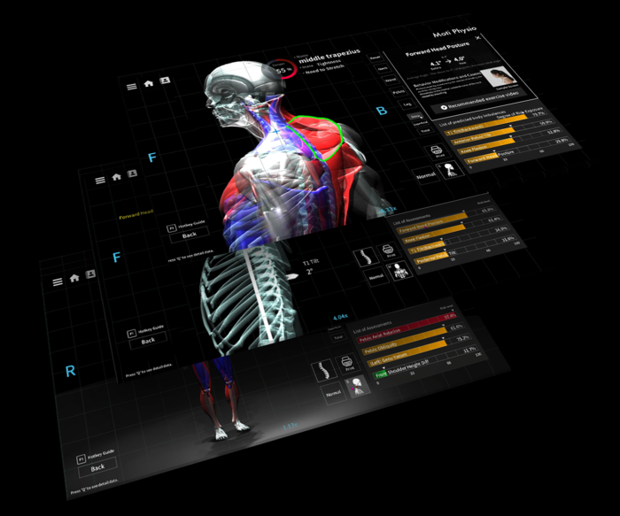 Analisi posturale 3D specialistica