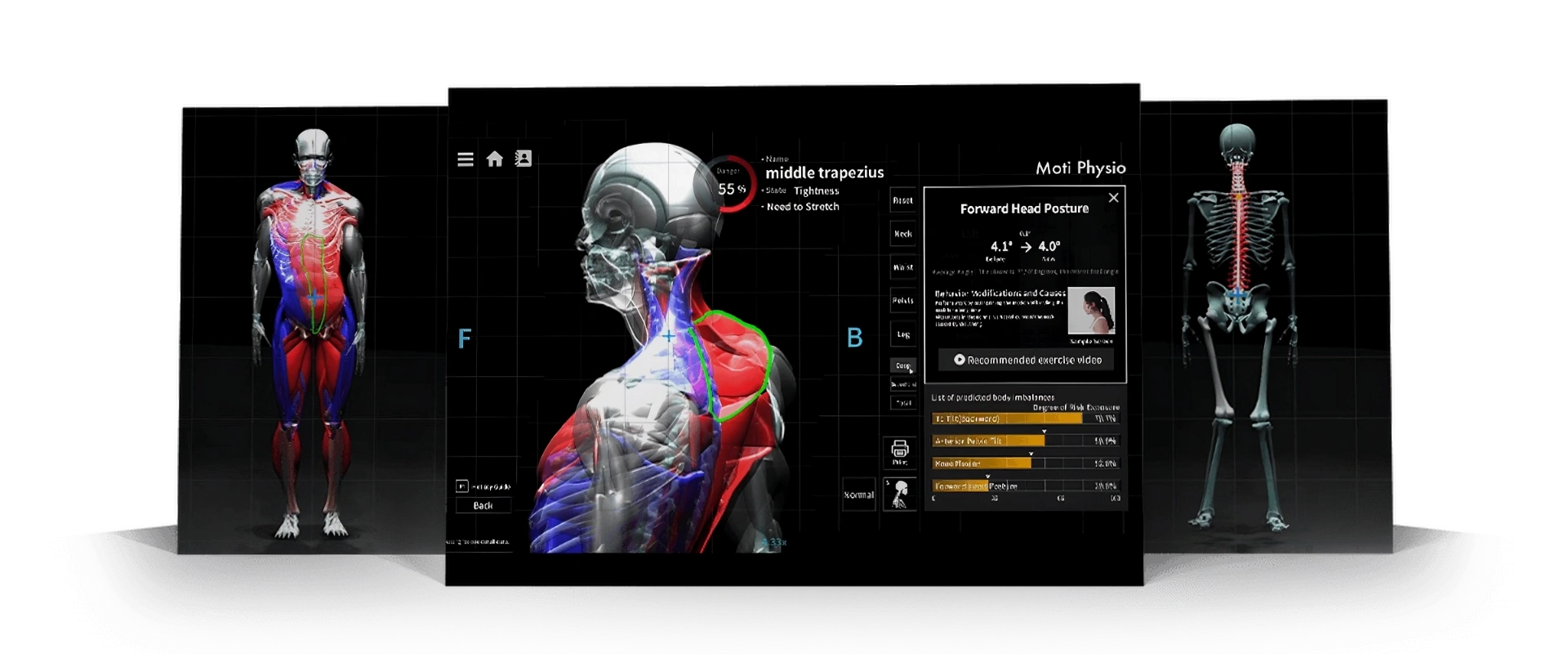 Analisi posturale 3D Moti Physio